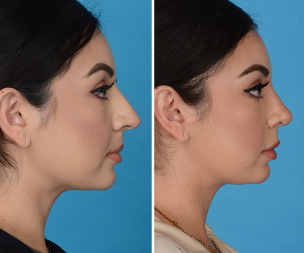 Screenshot 2025-11-06 094945